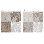 Immunohistochemical staining of human cerebral cortex, kidney, liver and skeletal muscle using Anti-LHPP antibody HPA009269 (A) shows similar protein distribution across tissues to independent antibody HPA009163 (B).