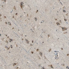 Immunohistochemical staining of human cerebral cortex shows moderate cytoplasmic positivity in neurons and glial cells.