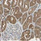 Immunohistochemical staining of human kidney shows moderate cytoplasmic positivity in cells in tubules.