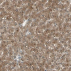 Immunohistochemical staining of human liver shows moderate cytoplasmic positivity in hepatocytes.