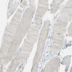 Immunohistochemical staining of human skeletal muscle shows very weak positivity in myocytes.