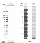 Western blot analysis in human cell lines A-431 and Caco-2 using Anti-LHPP antibody. Corresponding LHPP RNA-seq data are presented for the same cell lines. Loading control: Anti-PPIB.