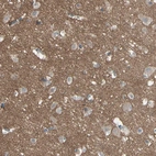 Immunohistochemical staining of human cerebral cortex shows strong positivity in neuronal processes in neuropil.