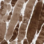Immunohistochemical staining of human skeletal muscle shows strong cytoplasmic positivity in myocytes.