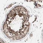 Immunohistochemical staining of human testis shows strong cytoplasmic positivity in cells in seminiferous ducts.