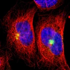 Immunofluorescent staining of human cell line A-431 shows localization to microtubule organizing center & vesicles.