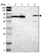 Lane 1: Marker [kDa] 230, 130, 95, 72, 56, 36, 28, 17, 11_br/_Lane 2: Human cell line RT-4_br/_Lane 3: Human cell line U-251MG sp_br/_Lane 4: Human plasma (IgG/HSA depleted)_br/_Lane 5: Human liver tissue