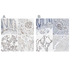 Immunohistochemical staining of human colon, kidney, lung and skeletal muscle using Anti-CD93 antibody HPA009300 (A) shows similar protein distribution across tissues to independent antibody HPA012368 (B).