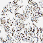 Immunohistochemical staining of human lung shows strong membranous positivity in endothelial cells.