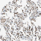 Immunohistochemical staining of human lung shows strong membranous positivity in endothelial cells.