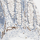Immunohistochemical staining of human colon shows strong membranous positivity in endothelial cells.