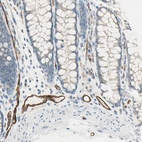 Immunohistochemical staining of human colon shows strong membranous positivity in endothelial cells.