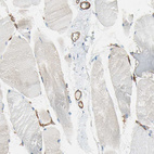 Immunohistochemical staining of human skeletal muscle shows strong membranous positivity in endothelial cells.