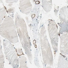 Immunohistochemical staining of human skeletal muscle shows strong membranous positivity in endothelial cells.
