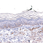 Anti-LAMA3 Antibody