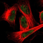 Immunofluorescent staining of human cell line U-251 MG shows localization to nucleoplasm.