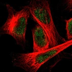 Immunofluorescent staining of human cell line U-251 MG shows localization to nucleoplasm.