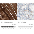 Anti-JPH1 Antibody