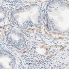 Immunohistochemical staining of human prostate shows low expression as expected.