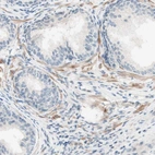 Immunohistochemical staining of human prostate shows low expression as expected.