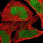 Immunofluorescent staining of human cell line A-431 shows localization to nucleus.
