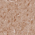 Immunohistochemical staining of human hypothalamus shows moderate cytoplasmic positivity in neurons.
