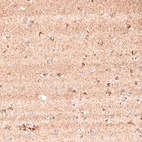 Immunohistochemical staining of human cerebral cortex shows moderate positivity in in neuropil and a subset of glial cells.
