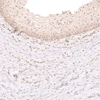 Immunohistochemical staining of human uterine cervix shows very weak positivity in squamous epithelial cells.