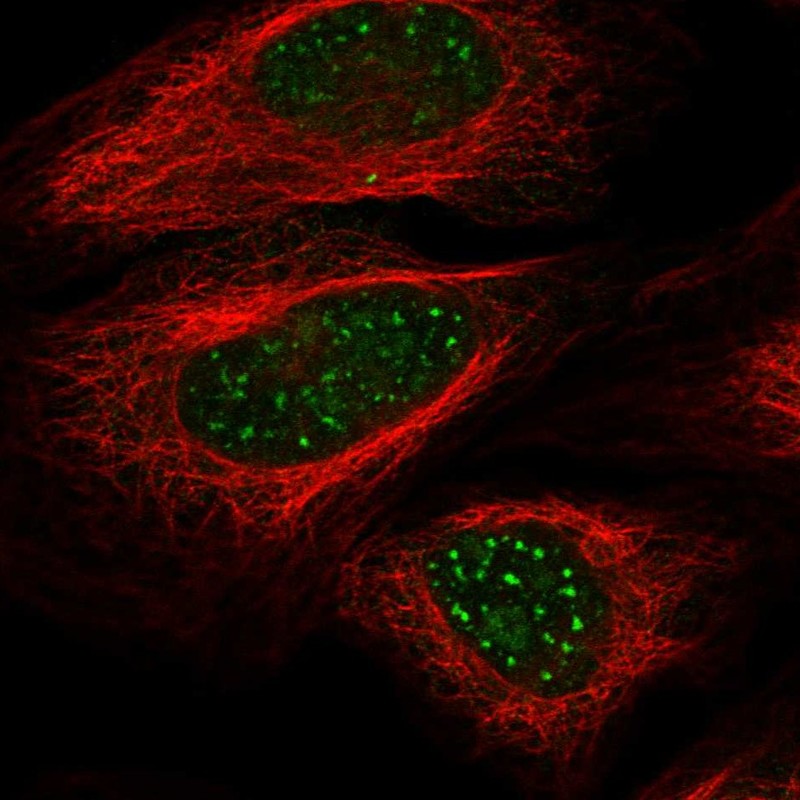 Anti-WRN Antibody