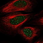 Anti-WRN Antibody