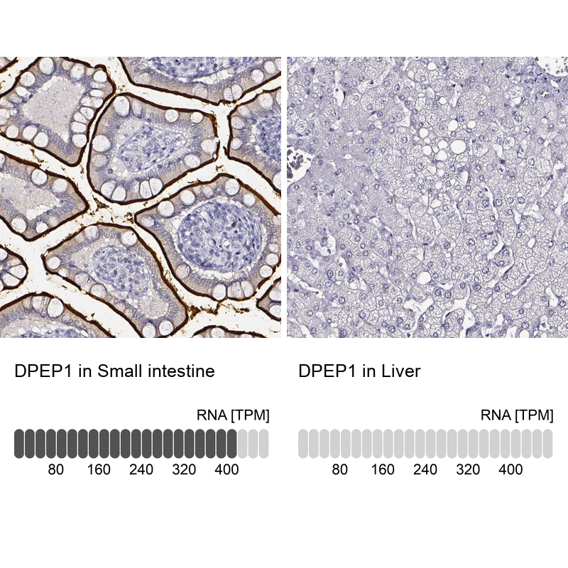 Anti-DPEP1 Antibody