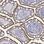 Immunohistochemical staining of human small intestine shows strong positivity in apical membrane in glandular cells.