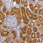 Immunohistochemical staining of human kidney shows strong membranous and cytoplasmic positivity in cells in tubules.