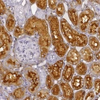 Immunohistochemical staining of human kidney shows strong membranous and cytoplasmic positivity in cells in tubules.