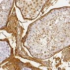 Immunohistochemical staining of human testis shows strong cytoplasmic positivity in Leydig cells.