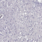 Immunohistochemical staining of human liver shows no positivity in hepatocytes as expected.