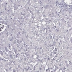 Immunohistochemical staining of human liver shows no positivity in hepatocytes as expected.