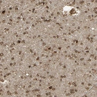 Immunohistochemical staining of human cerebral cortex shows strong cytoplasmic positivity in neurons.