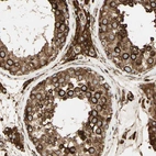Immunohistochemical staining of human testis shows strong cytoplasmic positivity in cells in seminiferous ducts.