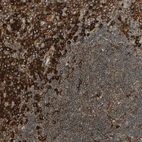 Immunohistochemical staining of human tonsil shows strong cytoplasmic positivity in non-germinal center cells.