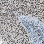 Anti-ZKSCAN3 Antibody