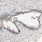 Immunohistochemical staining of human Prostate shows moderate nuclear and cytoplasmic positivity in glandular cells.