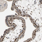 Immunohistochemical staining of human Placenta shows strong nuclear and cytoplasmic positivity in trophoblastic cells.