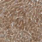 Immunohistochemical staining of human liver shows strong cytoplasmic positivity in hepatocytes.