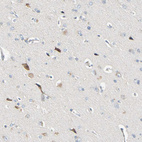 Immunohistochemical staining of human cerebral cortex shows moderate cytoplasmic positivity in neurons.