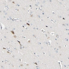 Immunohistochemical staining of human cerebral cortex shows moderate cytoplasmic positivity in neurons.