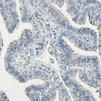 Immunohistochemical staining of human fallopian tube shows no positivity in glandular cells as expected.