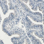 Immunohistochemical staining of human fallopian tube shows no positivity in glandular cells as expected.