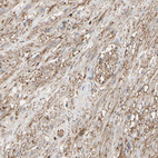 Anti-ANXA6 Antibody