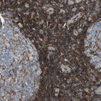 Immunohistochemical staining of human tonsil shows strong cytoplasmic positivity in non-germinal center cells.